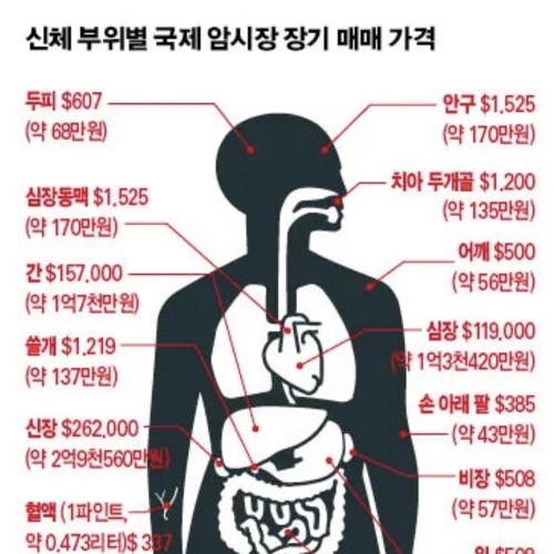 장기매매