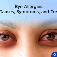 Best Swollen White Of Eye Allergy Treatment Reviews