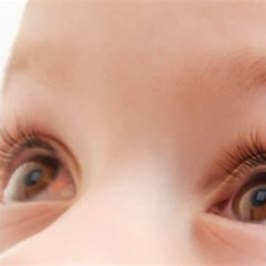 Best Baby Eye Red In Corner Treatment Reviews