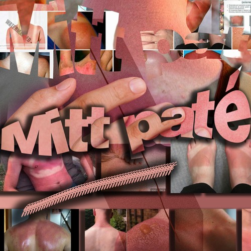 Mitt paté #41  The overall complexity of the music business...