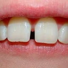 Moi em x Nguoi dep ngu - Qminh blend