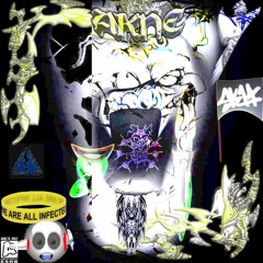 AKNE/XRØ$$ [LEiN G]