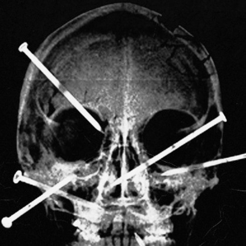 Diet Coke X Mind Dimension (Tor Remix)