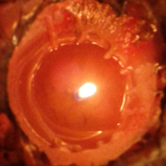 candle