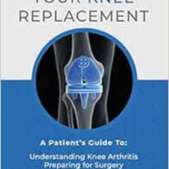 DOWNLOAD KINDLE 💏 Your Knee Replacement: A Patient's Guide To: Understanding Knee Ar