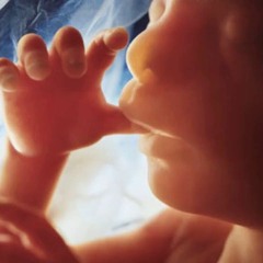 ABORTION, MURDER, CATASTROPHE