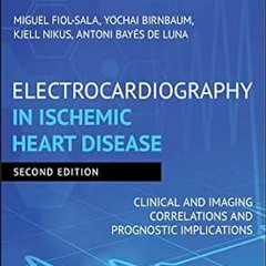 View EBOOK 💕 Electrocardiography in Ischemic Heart Disease: Clinical and Imaging Cor