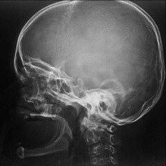 Psilocybin Experiment  (Ultra dilated pupils preview)