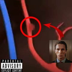 Aneurysm
