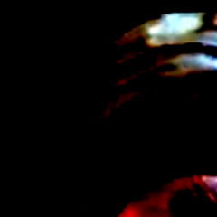 2-23-2025 (fracture)