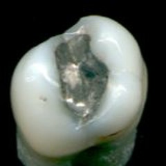 AMALGAMAT