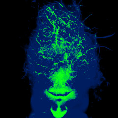 Ontelosta Onteloon 1