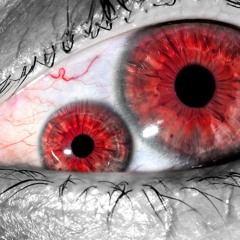 red eyes