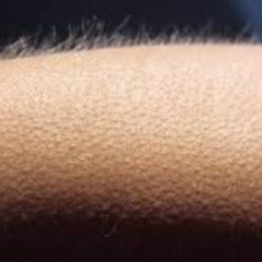 Frisson