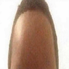 hairline