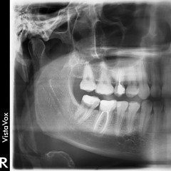 Hor raskardash - Ice baby