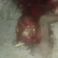 Wart Infested Genitalia