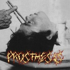 SEVERE COGNITIVE DECLINE