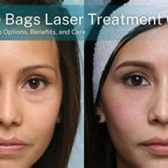 Best Treatment Under Eye Bags Reviews