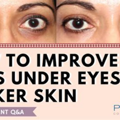 Best Treatment For Fine Lines Around Eyes Reviews