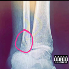 Worldwide Gary "Too Sweet For Me Remix"  (Ankle Tape)