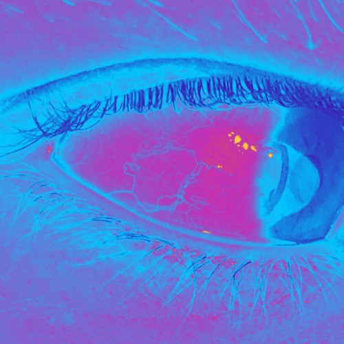 NOT EVERYTHING IS BROKEN