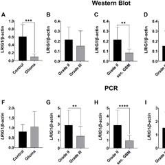 Lower LRIG1 Expression Linked to Aggressive Gliomas