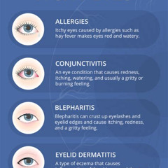 Best Itchy And Watery Eyes Treatment Reviews