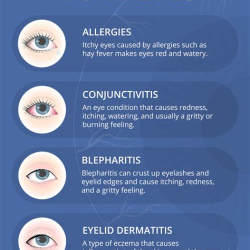 Best Itchy And Watery Eyes Treatment Reviews