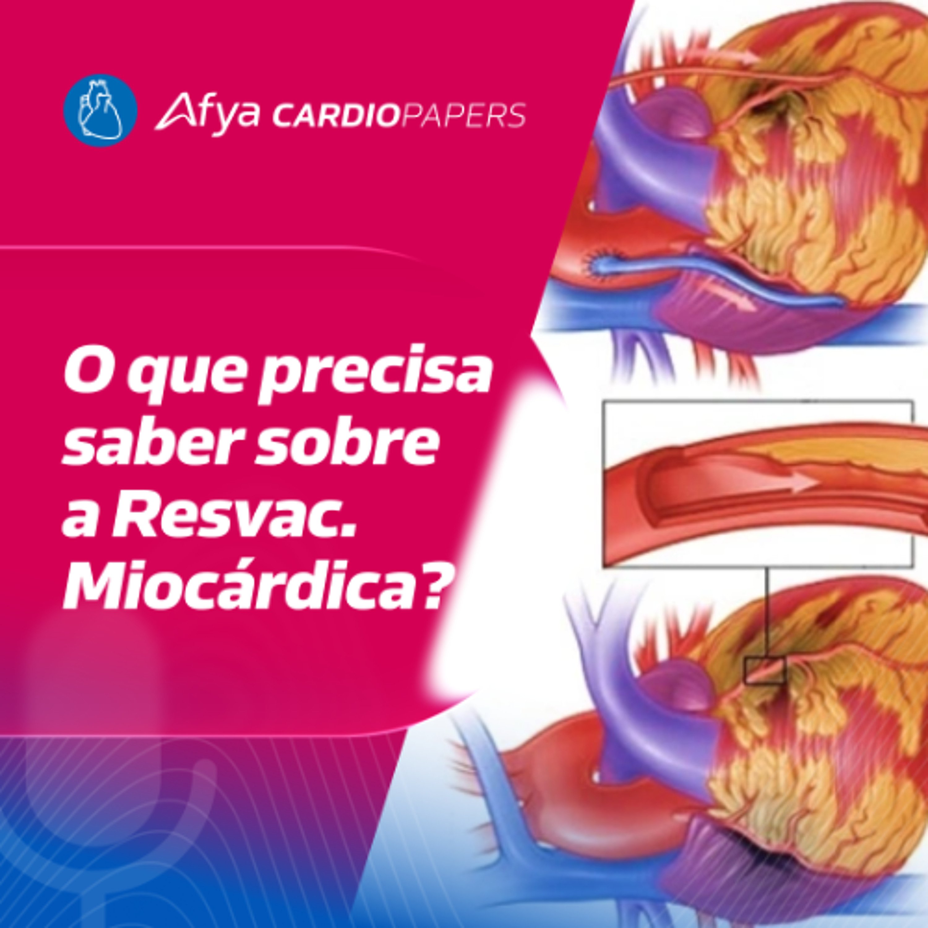 Cirurgia de Revascularização Miocárdica para o Clínico