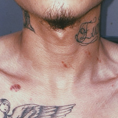 love bites