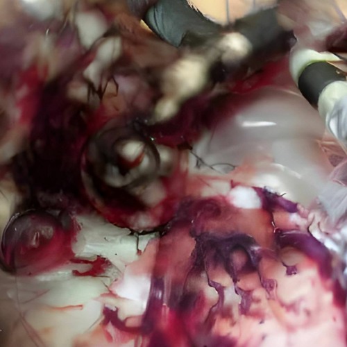 MOTZ Premiere: YANA ETC - PARAPSYCHAOS [SUNTHOID016]