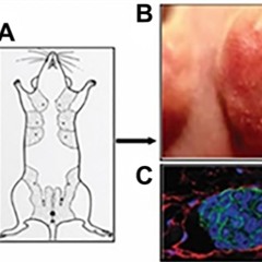 Tumor Dormancy Initiated by Lymphovascular Embolus