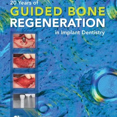 PDF/READ 20 Years of Guided Bone Regeneration in Implant Dentistry: Second Edition