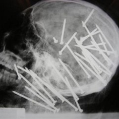 Artery