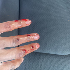 Glizzy - what you want