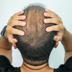 Can Mechanisms of Hair Loss Shed Light on Cancer and Aging?