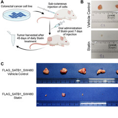 Cholesterol-Lowering Drugs Show Promise Against Colorectal Cancer
