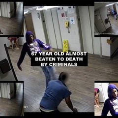 67 Year Old Almost Beaten To Death By Criminals