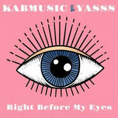 Southside Hustlers - Right Before My Eyes (Kabmusic & Yasss Remix)  Free Download