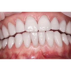 die (水中ブートル Rory in early 20s)