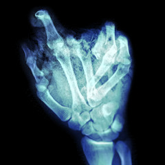 breaking the bones in my hands (prod. freger)
