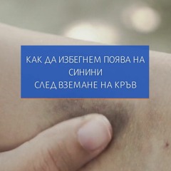 Как да избегнем синините след взимане на кръв