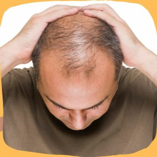 Stream Hair Loss in 20s: How To Prevent Balding? (For Men) by Homeopathy  Kolkata | Listen online for free on SoundCloud