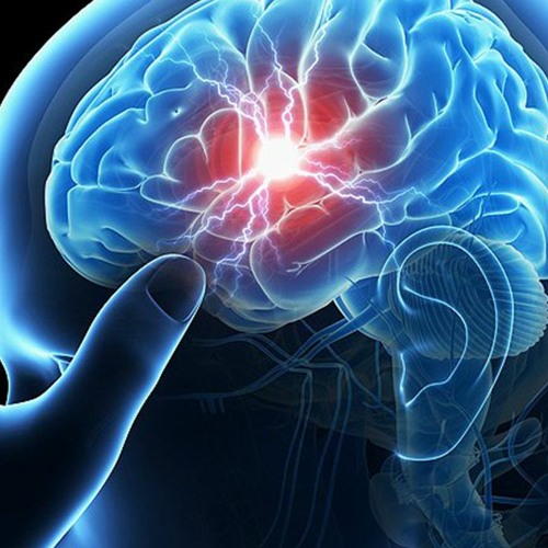 Cerebrovascular Disorders (ETDF)