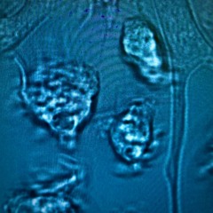 toxins (moschella)