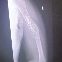 L1