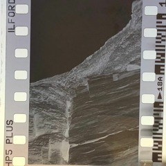 Superficial Brain Activity