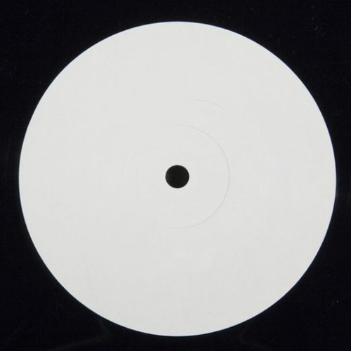Lazer Beams (Adam Trace needs to relax Edit)
