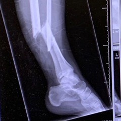 Leg work + Daylz & Geeohhs